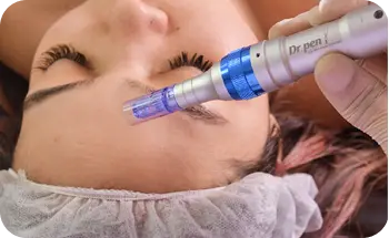 Tratamiento estético facial profesional en Victoria Skin Care